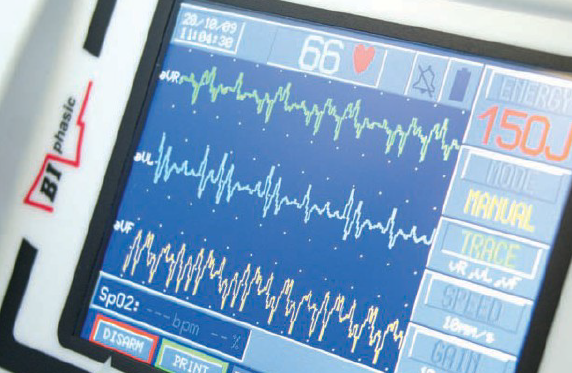 defibrilator